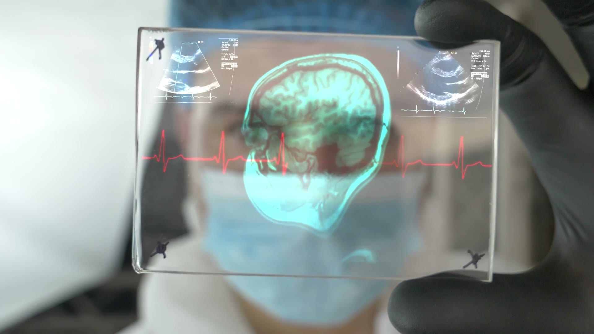 A brain scan visualization reviewed during a rehabilitation consultation